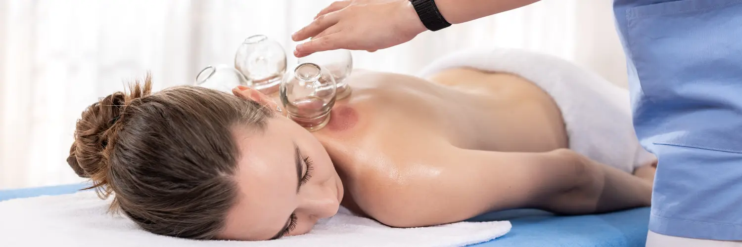 Frau erhält Schröpfbehandlung in einem Spa. Schröpfkopf-Therapie. Eine Behandlung, die in der traditionellen chinesischen Medizin zur Schmerzlinderung und für andere gesundheitliche Vorteile eingesetzt wird.